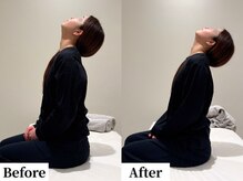 ソレア(Solea)/首こり・肩こり改善1回目