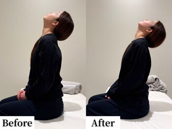 ソレア(Solea)/首こり・肩こり改善1回目