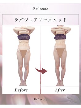 ボディケアルーム リフレキュア 中野(REFLECURE)/全身のライン変化