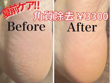 ワンフォアスマイル 北谷店(One for smile)の雰囲気（リピート続出！人気のフットケア！角質除去♪驚きの潤い！）