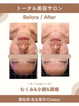 シャルール プラス(Chaleur+)/