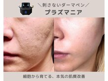 ラクシュミー(laksmi)