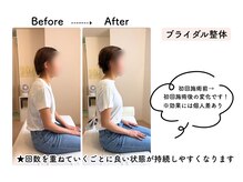 ルリアン骨盤小顔整体院 横浜/before/after