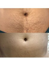 メンズプシュケ(men's PSYCHE)/