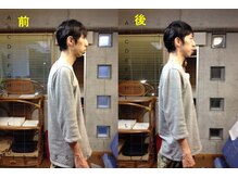 アトラス ストレートカイロプラクティック/猫背・背骨の歪み