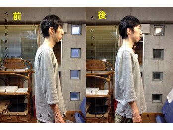 アトラス ストレートカイロプラクティック/猫背・背骨の歪み