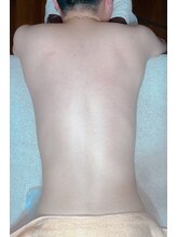 エムズリボーン 那覇店(M's ReBorn)/Lパーツ(各部位)¥4500~