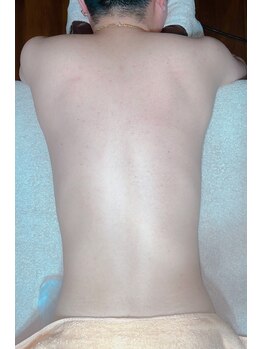 エムズリボーン 那覇店(M's ReBorn)/Lパーツ(各部位)¥4500~