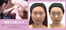 【New Open】韓国肌管理&小顔コルギ専門店 ～HARRY・ハリー～ 神戸三宮店
