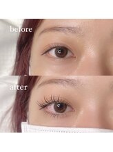 ノラ ギンザ(NORA GINZA)/before after