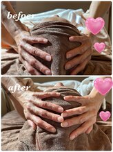 シャルマン(Charmant)/頭蓋骨調整して小顔に変身！！