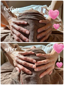 シャルマン(Charmant)/頭蓋骨調整して小顔に変身!!