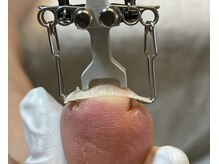 バフネイル(Buff nail)の雰囲気（巻き爪ケアなどケアメニュー多数☆潤いに満ちた健やかな爪肌へ♪）