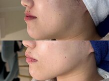 ロイ 初生店(LOI)/最新最強のリフトアップ機械導入