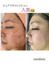 ナチュラルビューティラテ(NATURAL BEAUTY LATTE)/ピュアラボコレクション入賞