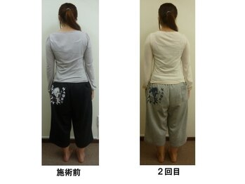整体処たまゆら/体の歪み・傾きビフォーアフター
