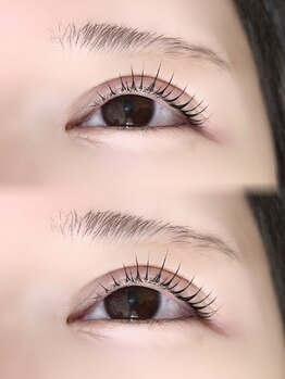 アイモア 金山店(eye mor.)/ペッタロッド使用