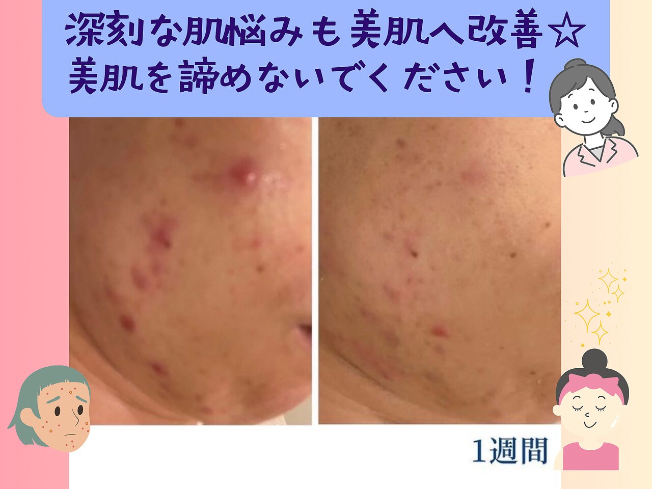 エラフリー｜ホットペッパービューティー