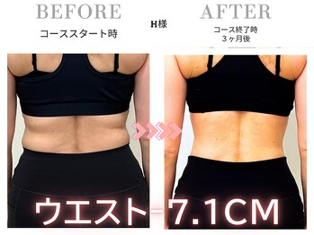 スリービーダイエット 町田店/ダイエットビフォーアフター