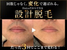 ダイヤ 名古屋中川区店(Daiya)