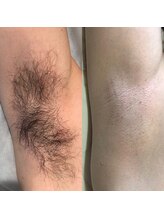 メンズプシュケ(men's PSYCHE)/