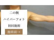 肌音色/■二の腕ハイパーフォト　40代～