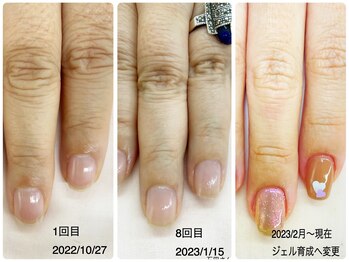 自爪育成→ジェル育成