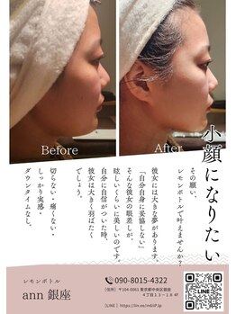 アン 銀座(ann)/♯レモンボトル