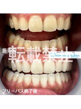 ホワイトニングサロン 福岡天神店/ホワイトニング