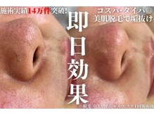 アルゴ 敦賀店(ALGO)の雰囲気(フェイシャルメニューも充実◎お肌悩みも一緒に解決♪)