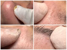 サラグランデ(Sara Grande)/毛穴の中からこんなに！