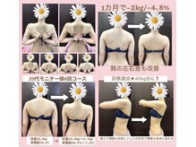 スワン 新栄店(SWAN)の雰囲気（独自の手技で肩の盛り上がりを改善/立体的な“肩甲骨美”を実現）