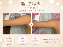 エステティックサロン フェアリー(ESTHETIC SALON FAIRLY)の雰囲気(有名モデルも御用達☆圧倒的!確実な結果◎【脂肪冷却マシン】)