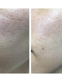 ソラ(sora)/クリスティーナ