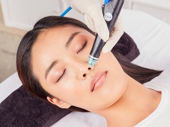 ペールノエル 沼津店(PERENOEL)の写真/東海地区で希少な、hydrafacial(ハイドラフェイシャル)導入店！毛穴開きや詰まりの改善、ハリ艶UPに♪