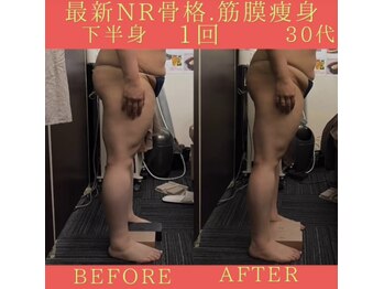 リラクゼーションサロン ラキ(laki)/NR筋膜骨格調整1回(痩身/腰痛)