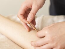 武蔵小杉鍼灸接骨院の雰囲気（痛みの少ない施術で初めての方でも◎[腰痛/足のむくみ・疲れ]）