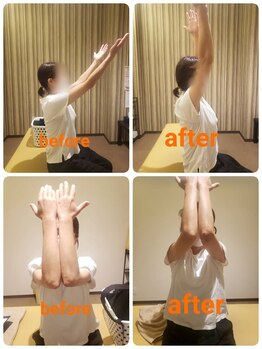 若松整体院 太白区院/肩甲骨はがし＆骨盤矯正☆