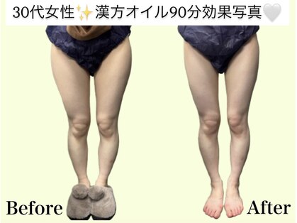 アオレニア(ao.lenia)の写真