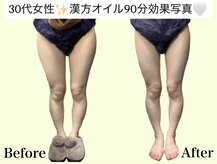 アオレニア(ao.lenia)