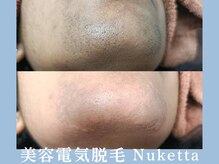 ヌケッタ 池袋の雰囲気(白髪・眉毛・産毛・VIO・ヒゲ脱毛お任せください池袋/眉毛脱毛)