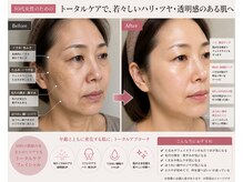 ルナ クレッシェンテ(Luna crescente)/50代からの肌質改善なら当サロン