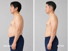ミネルバ(MINERVA)/【施術例】　40代男性　痩身