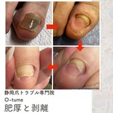 オツメ 静岡(O-tume)