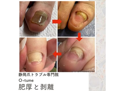 オツメ 静岡(O-tume)の写真