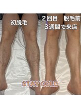 ステイゴールド 新百合ヶ丘(STAY GOLD)/足脱毛！ツルツルが流行ります！
