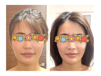 アゴラ/【小顔】豊富な施術実績有り