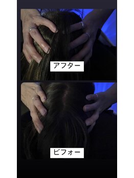 トトロ 明石大久保店(Totoro)/浮腫みが取れてスッキリ♪