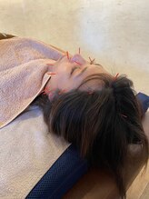 守谷やまゆり鍼灸整骨院/意外と痛みが少ない！！！