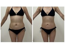 アミクール エステティックサロン(amicoeur)/60代でもこの変化